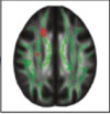 thumbnail image from paper
