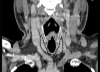 thumbnail image from paper
