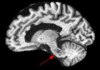 thumbnail image from paper