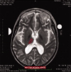 thumbnail image from paper