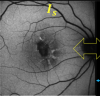 thumbnail image from paper