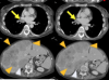 thumbnail image from paper