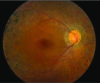 thumbnail image from paper