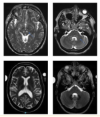 thumbnail image from paper