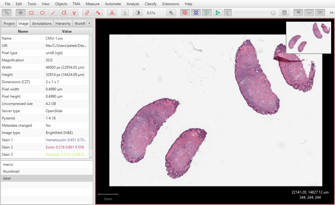 QuPath GUI image